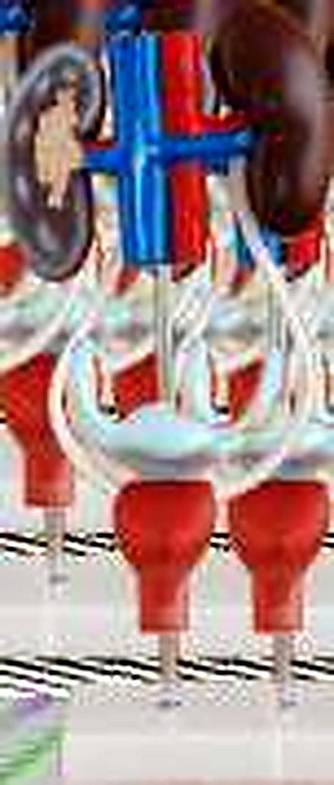FEMALE UROGENITAL SYSTEM (IMPORTED)-