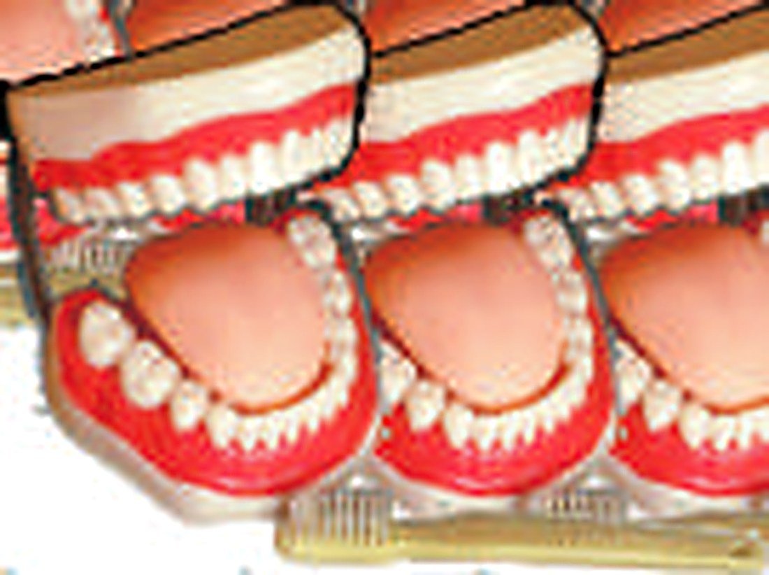 ADULT GUM TEETH MODEL - This model is to serve for demonstation in mouth protection and relative clinical teaching. With brush. (Equivalent Model No. XC-403)
