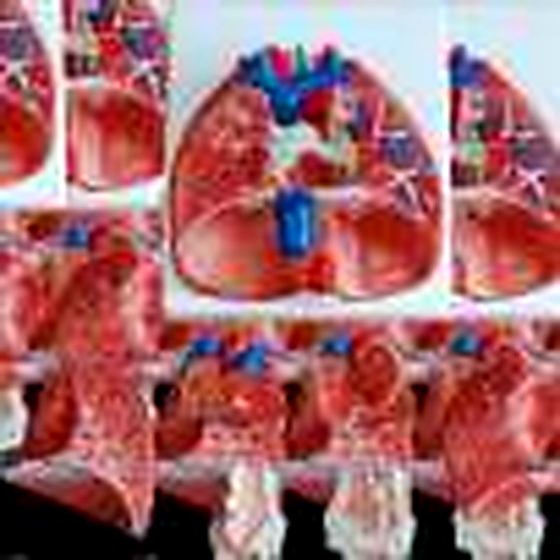 LARYNX, HEART & LUNGS MODEL(IMPORTED) -