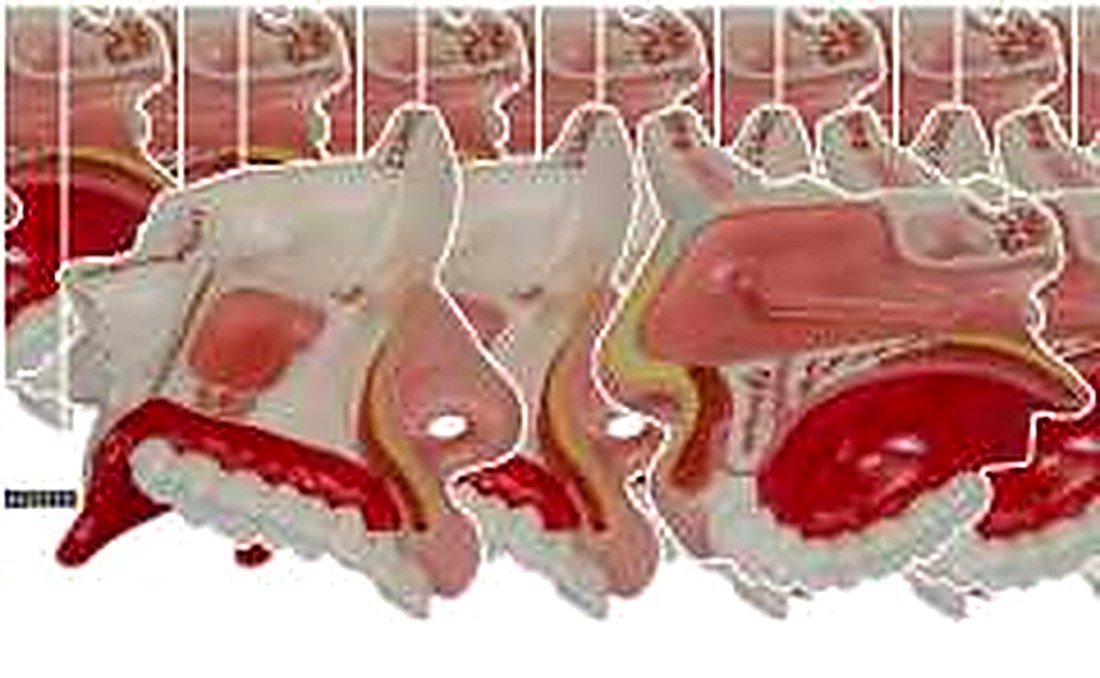 MODEL OF ANATOMICAL NASAL CAVITY