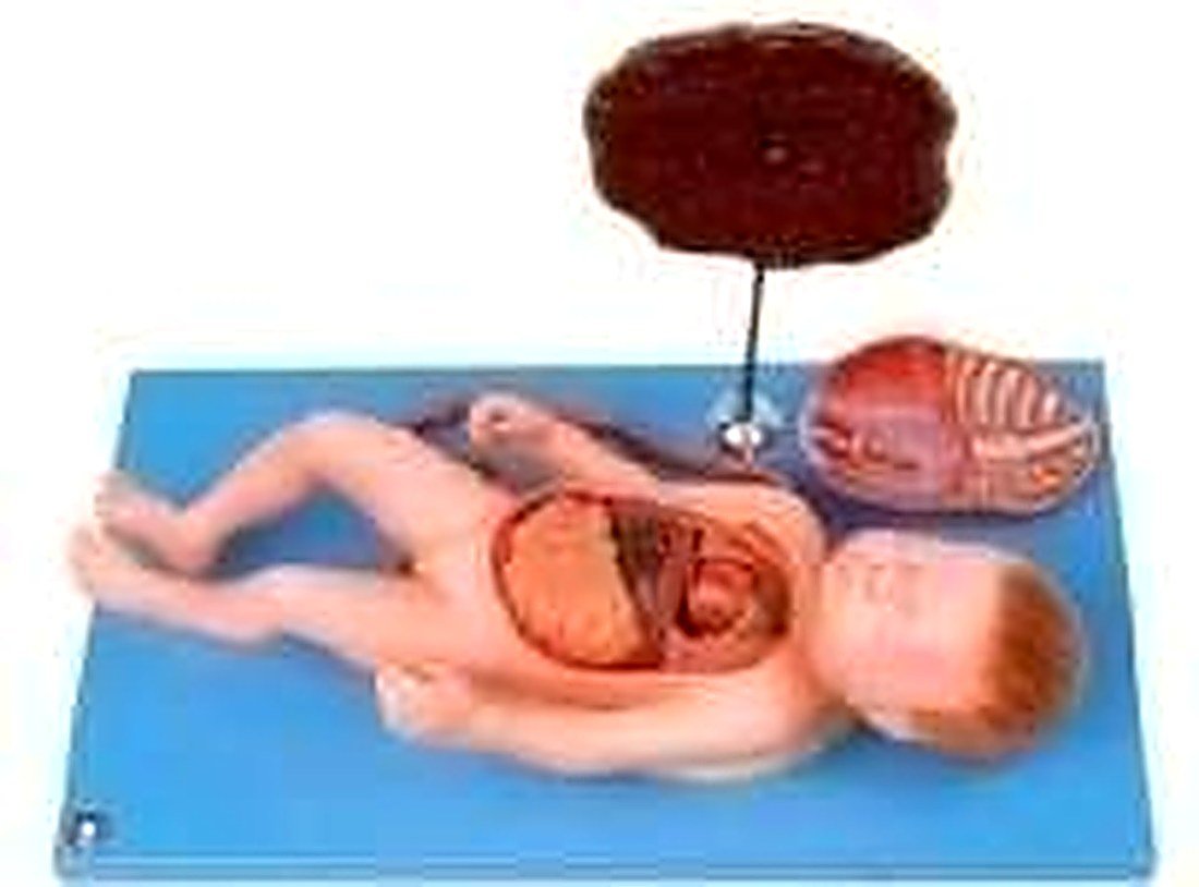 FETUS WITH VISCUS AND PLACENTA
