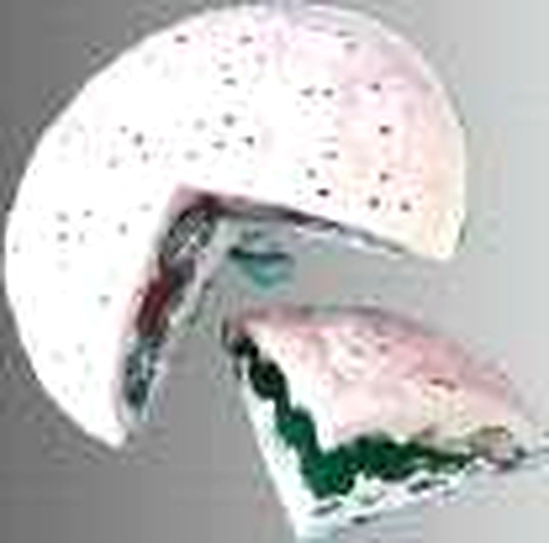 HUMAN PLACENTA ANATOMISE MODEL (IMPORTED) - alternate view