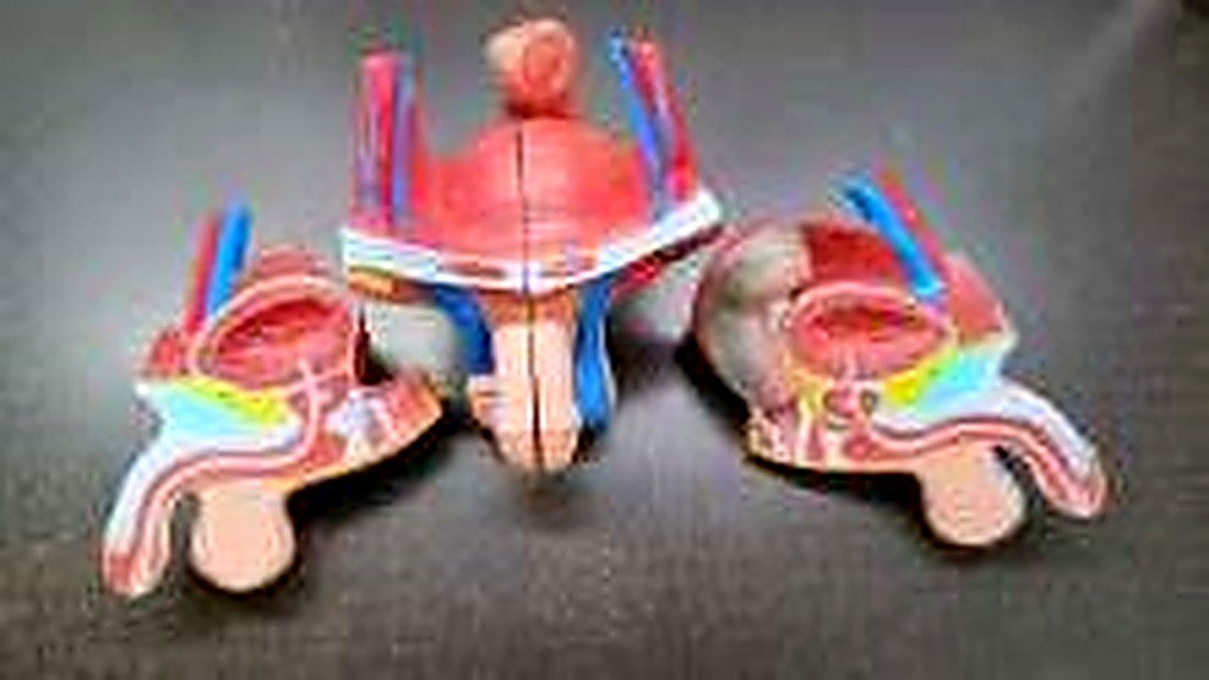MALE GENITAL ORFANS MODEL WITHOUT STAND (IMPORTED)-