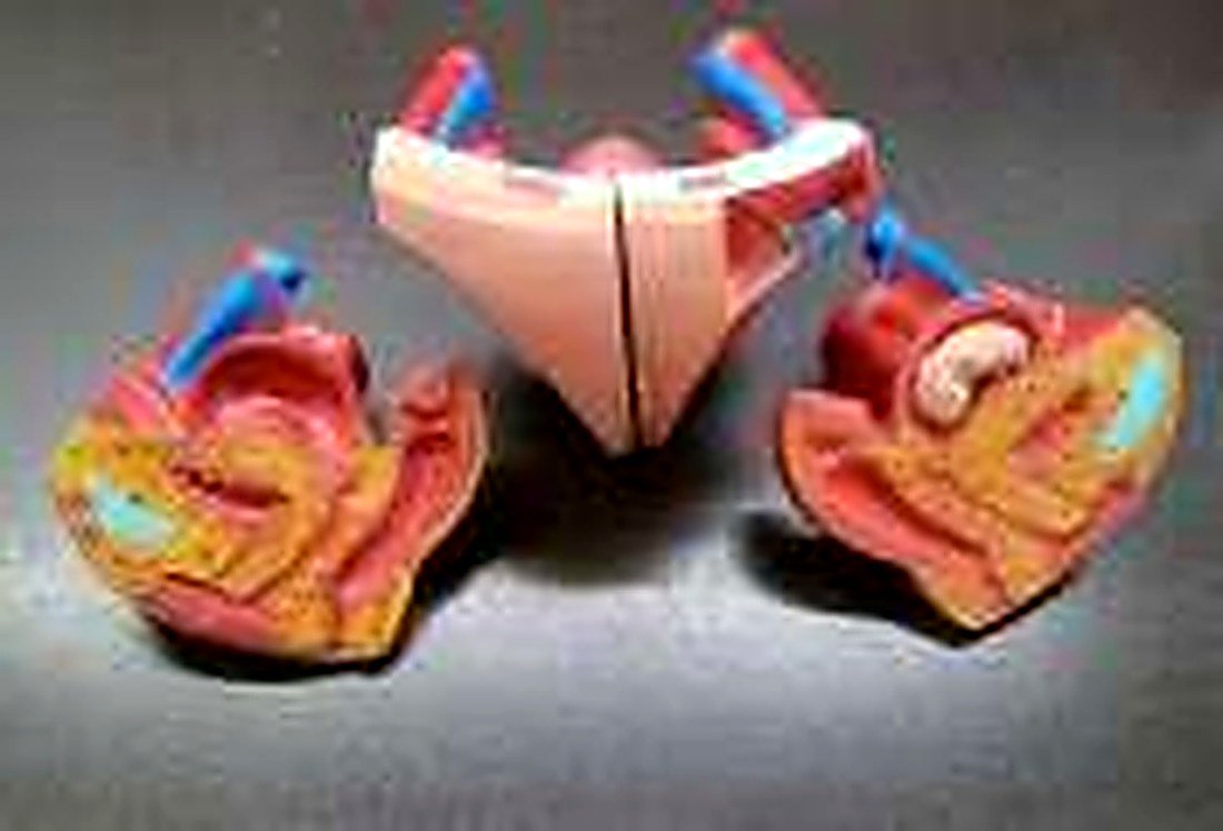 FEMALE GENITAL ORFANS MODEL WITHOUT STAND (IMPORTED)-