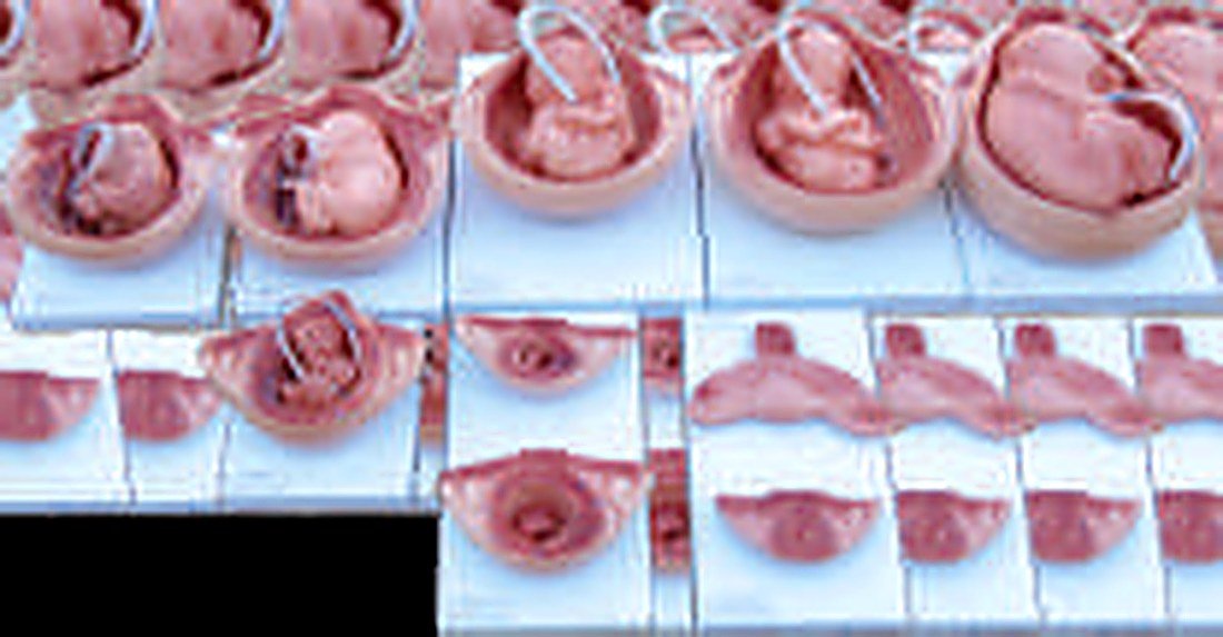 DEVELOPMENT PROCESS OF A FETUS