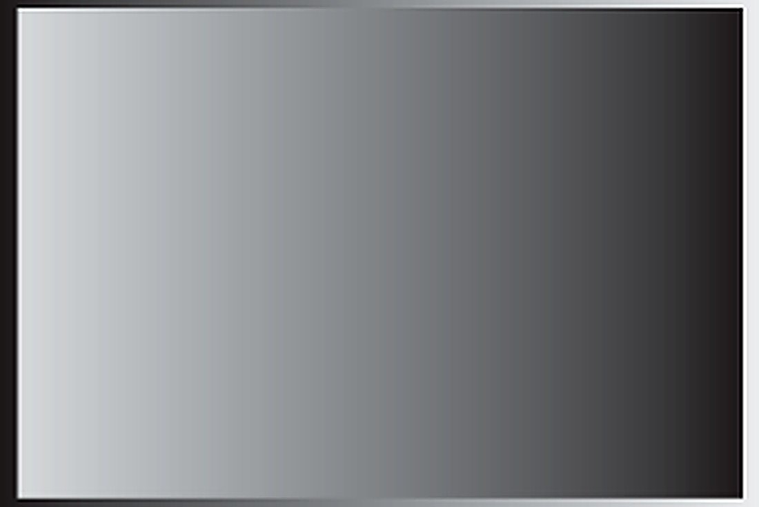 ELECTRONIC UTHERAL CATHERIZATION AND alternate view