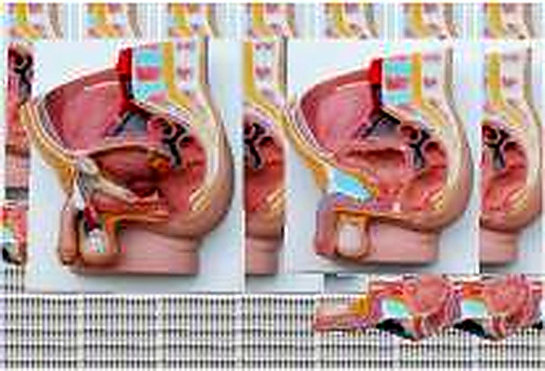 HUMAN MALE PELVIS SECTION (2 PART)