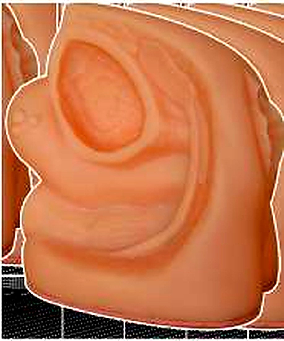 ADVANCED FEMALE INTERNAL & EXTERNAL