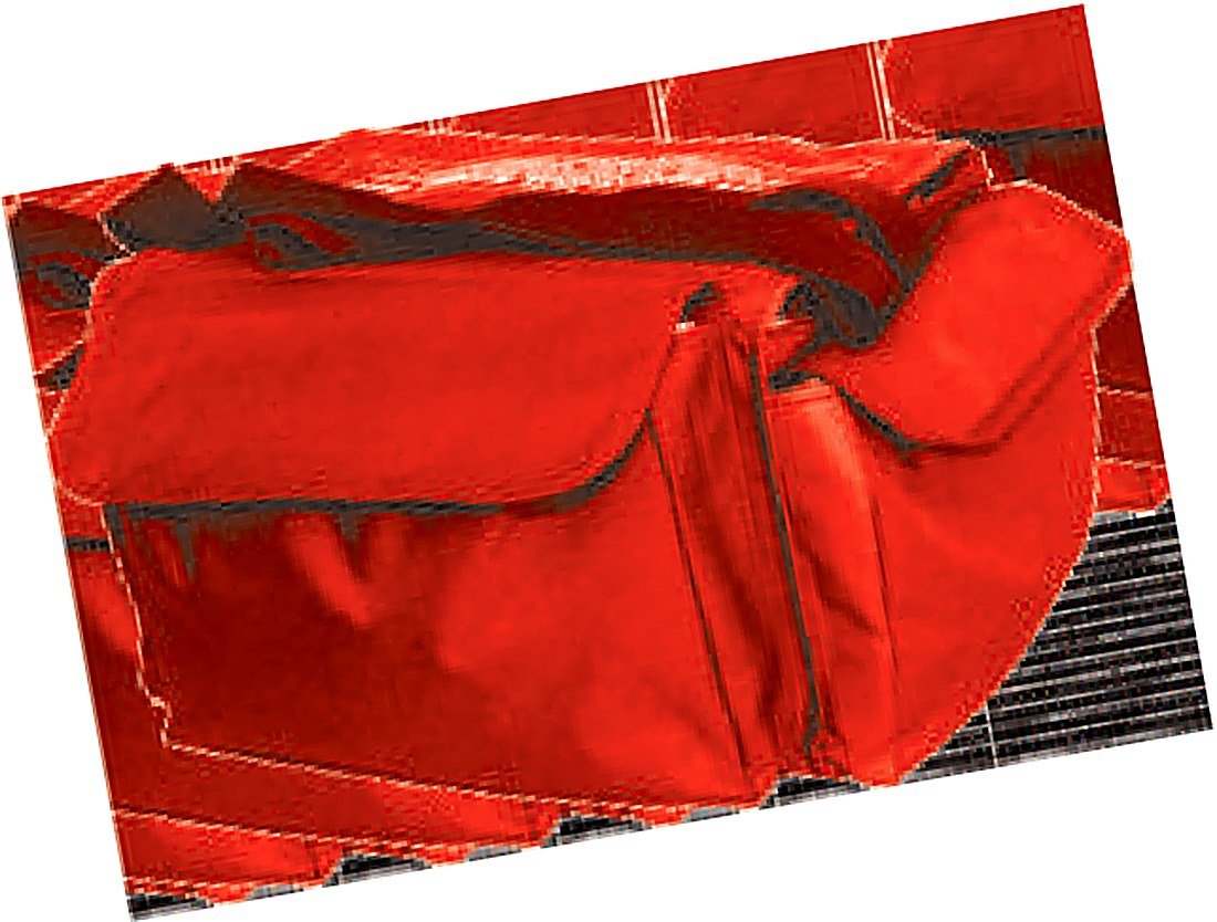 SURGICAL KIT FOR COMMUNITY HEALTH (with
