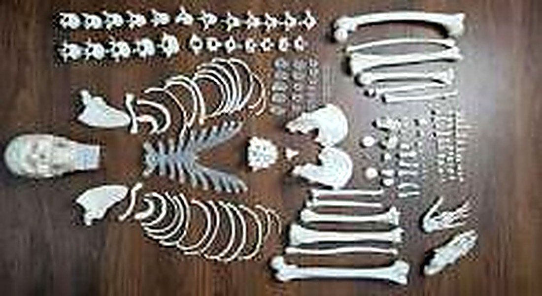 DISARTICULATED SKELETON (IMPORTED)