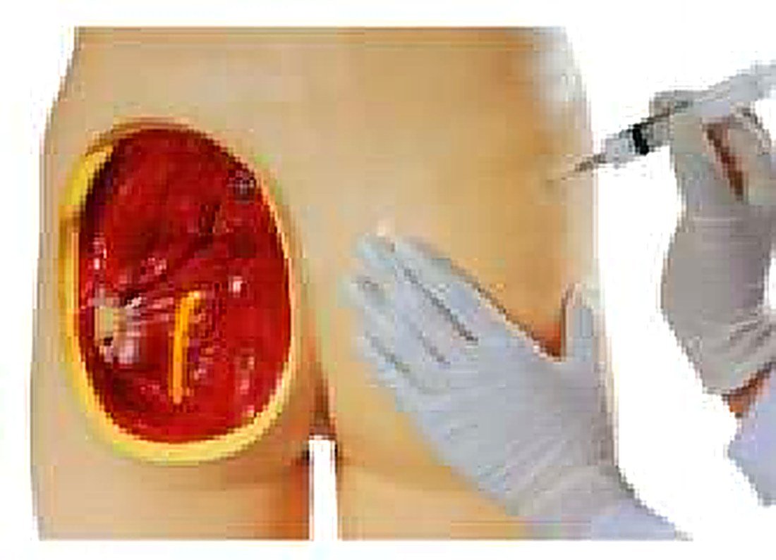 ADULT INTRAMUSCULAR INJECTION TRAINING