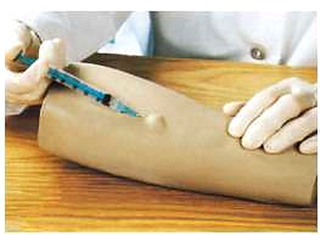ARM INTRADERMAL INJECTION MODEL