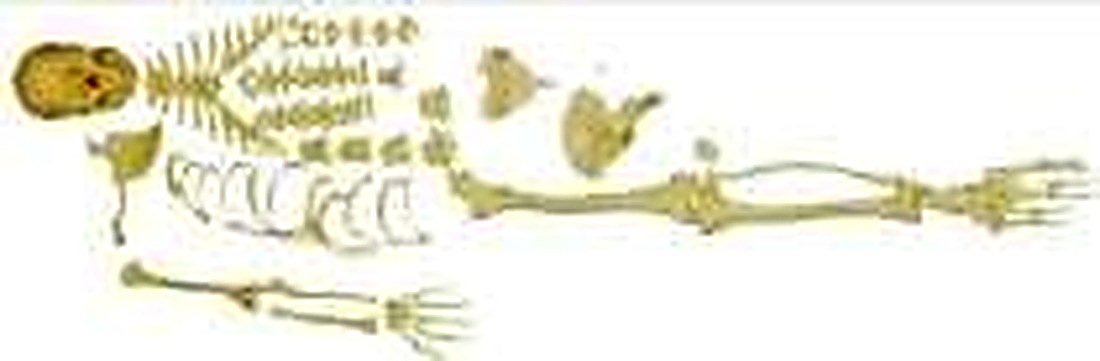 DISARTICULATED HUMAN SKELETON