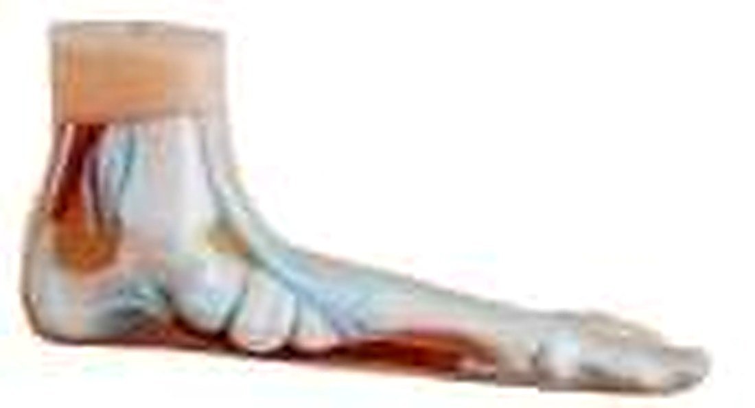 FOOT ANATOMY MODEL 3 PARTS/NORMAL, FLAT AND ARCHED FOOT (IMPORTED)- These