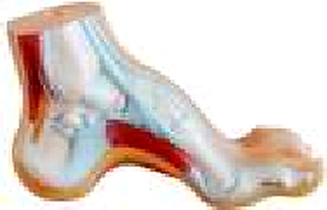 FOOT ANATOMY MODEL 3 PARTS/NORMAL, FLAT AND ARCHED FOOT (IMPORTED)- These alternate view