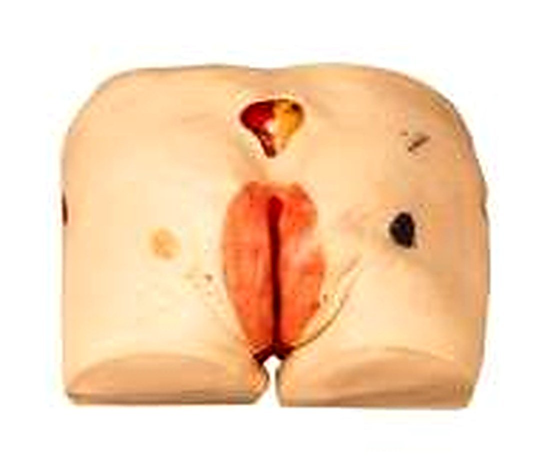 DECUBITUS ULCER CARE SIMULATOR