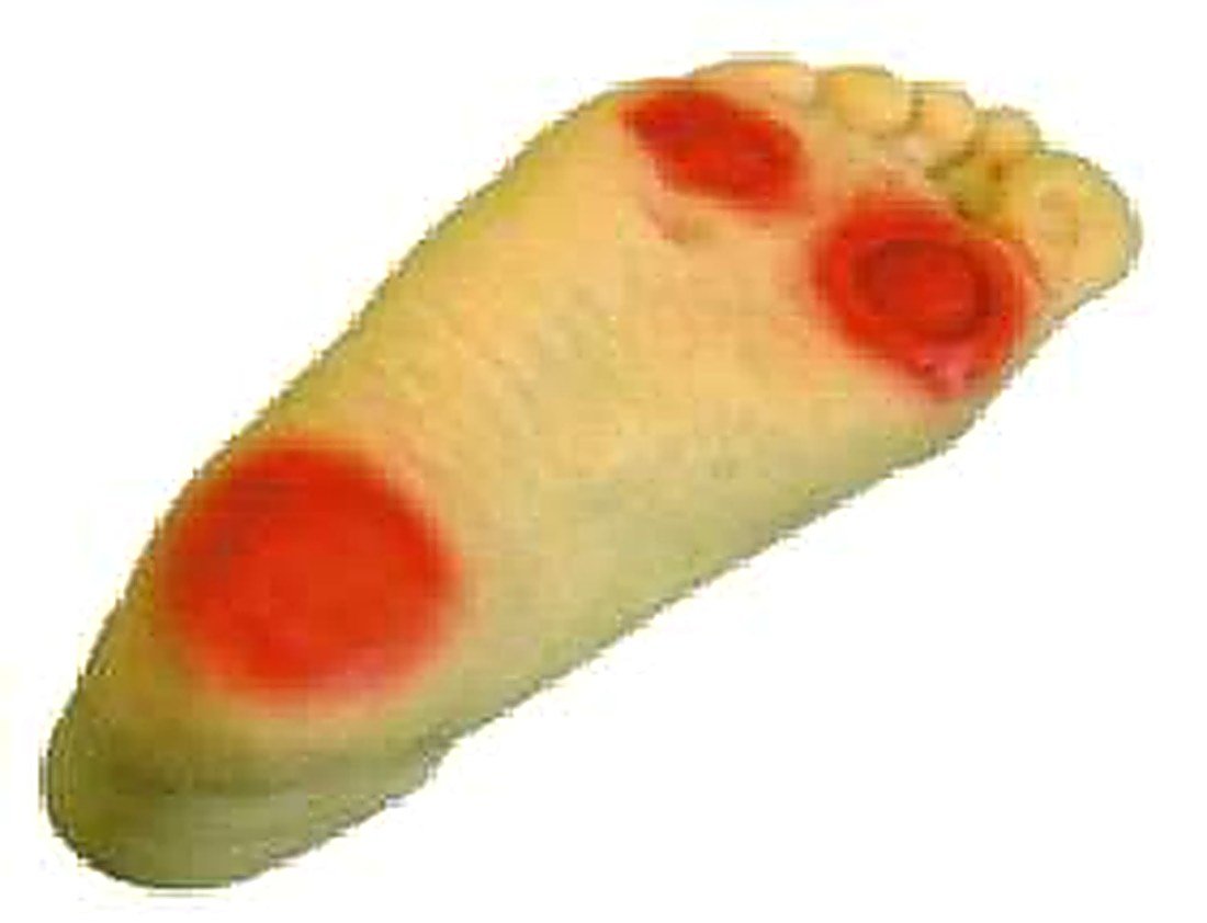 ADVANCED DIABETIC FOOT CARE MODEL
