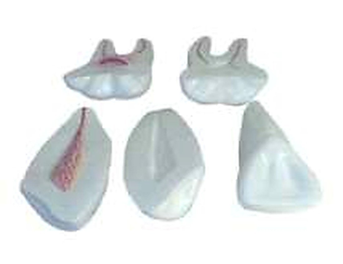 EXPANSION MODEL OF HUMAN TEETH - This