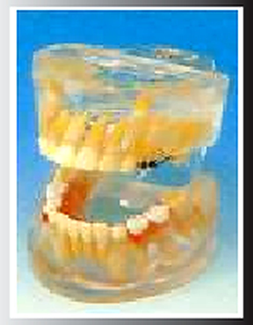 TRANSPARENT MILK TEETH DEVELOPMENT