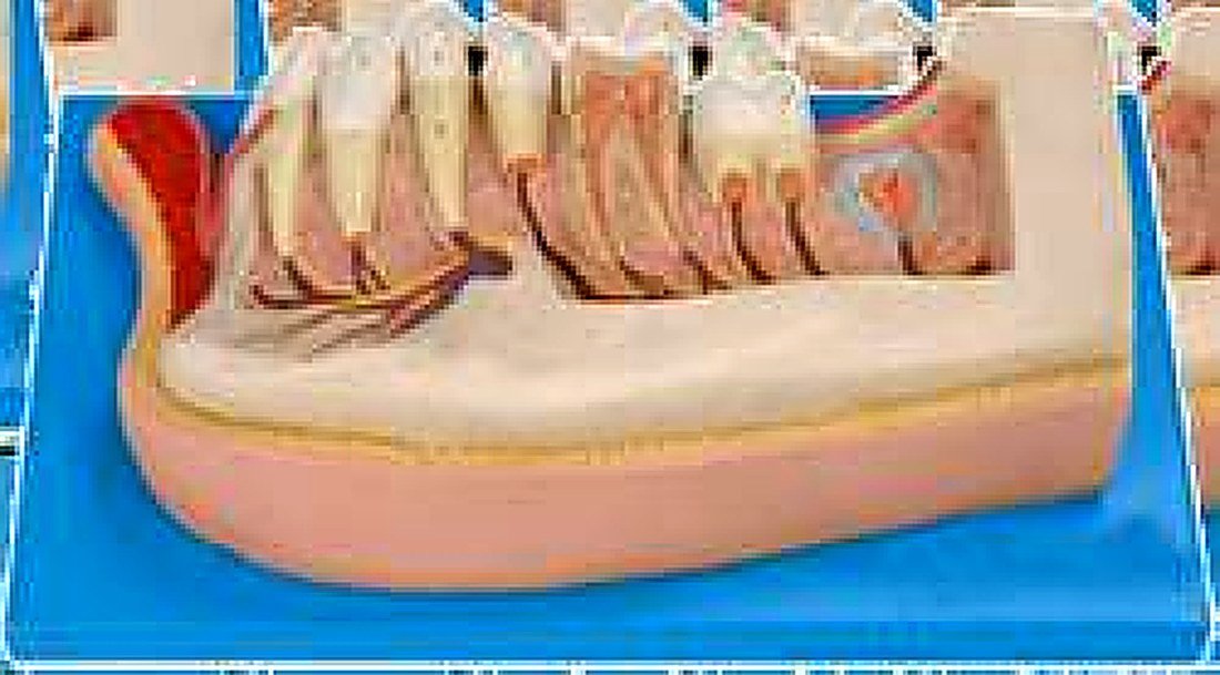 LOWER JAW OF 12-YEARS OLD - The Model