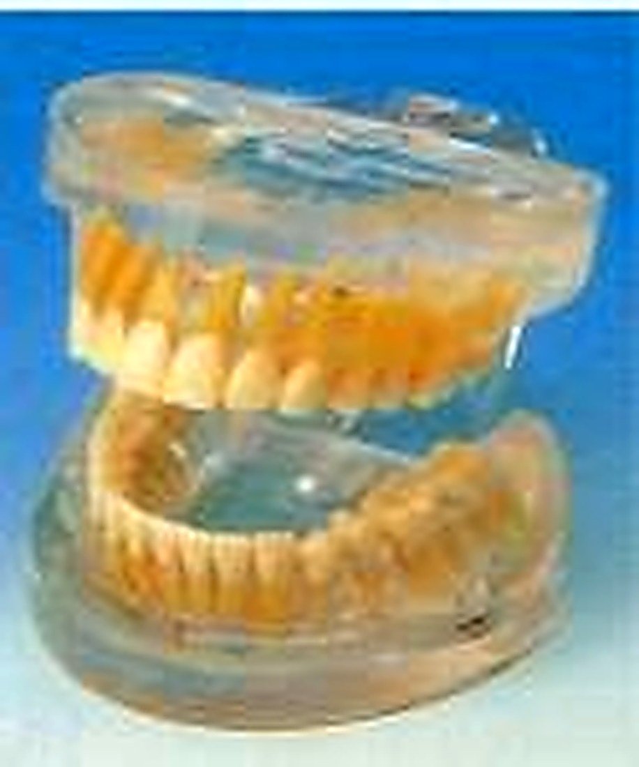 TRANSPARENT ADULT TEETH MODEL - The