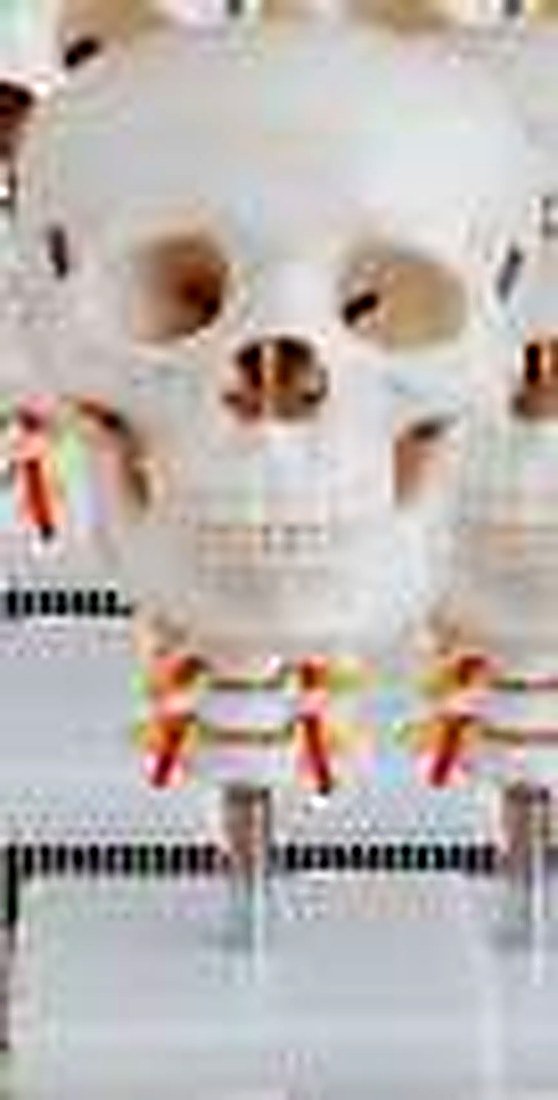 SKULL WITH CERVICAL SPINE (IMPORTED) - This
