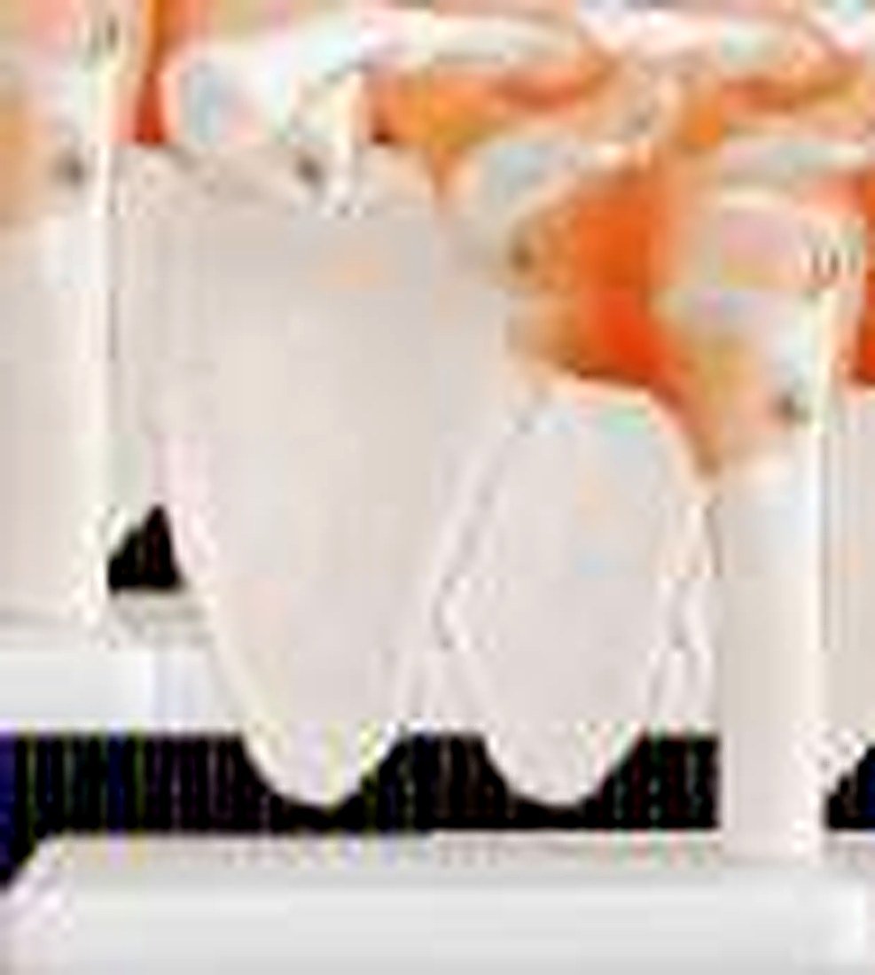 SHOULDER JOINT MODEL WITH LIGAMENTS (IMPORTED)