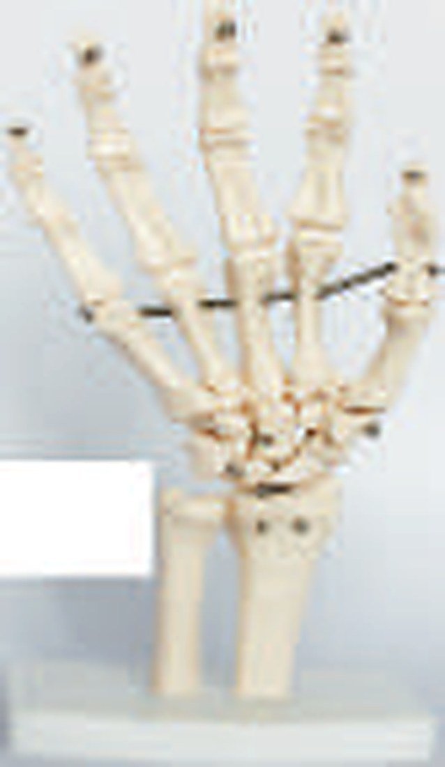 HAND JOINT (IMPORTED) - Demonstrate all the hand functionality and the external anatomical structures. Made of PVC plastic, life size, on stand. Size: 11.5x8x24.5CM.