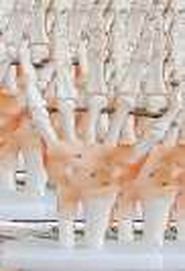 HAND JOINT MODEL WITH LIGAMENTS