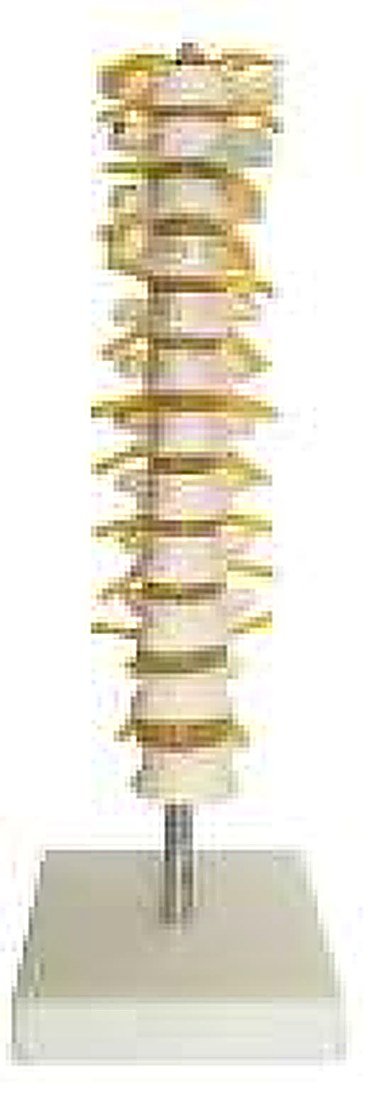 THORACIC SPINAL COLUMN(IMPORTED) -This alternate view