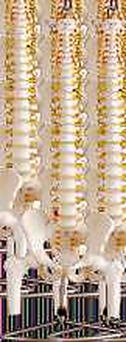 CERVICAL SPINE WITH NECK ARTERY AND OCCIPITAL BONE (IMPORTED) - Consisted of alternate view