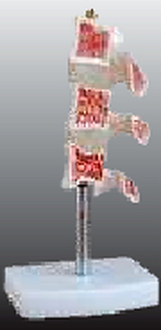VERTEBRAL OSTEOPOROSIS MODEL