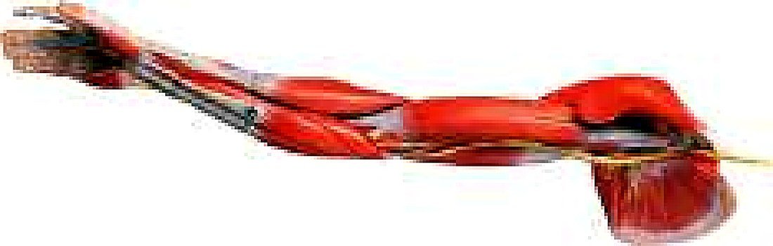 MUSCLES OF ARM WITH MAIN VESSELS AND