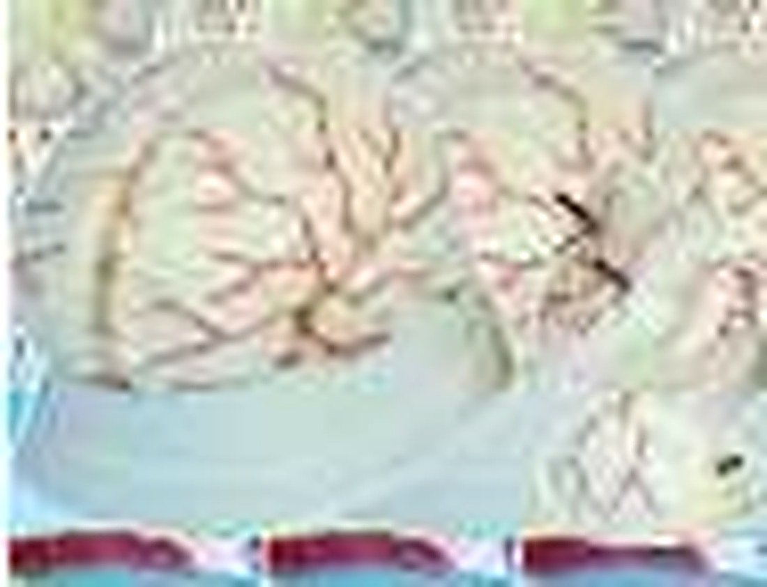BRAIN WITH ARTERIES 8 PARTS (IMPORTED)-