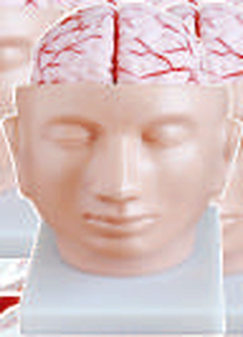 BRAIN WITH ARTERIS ON HEAD (IMPORTED)-