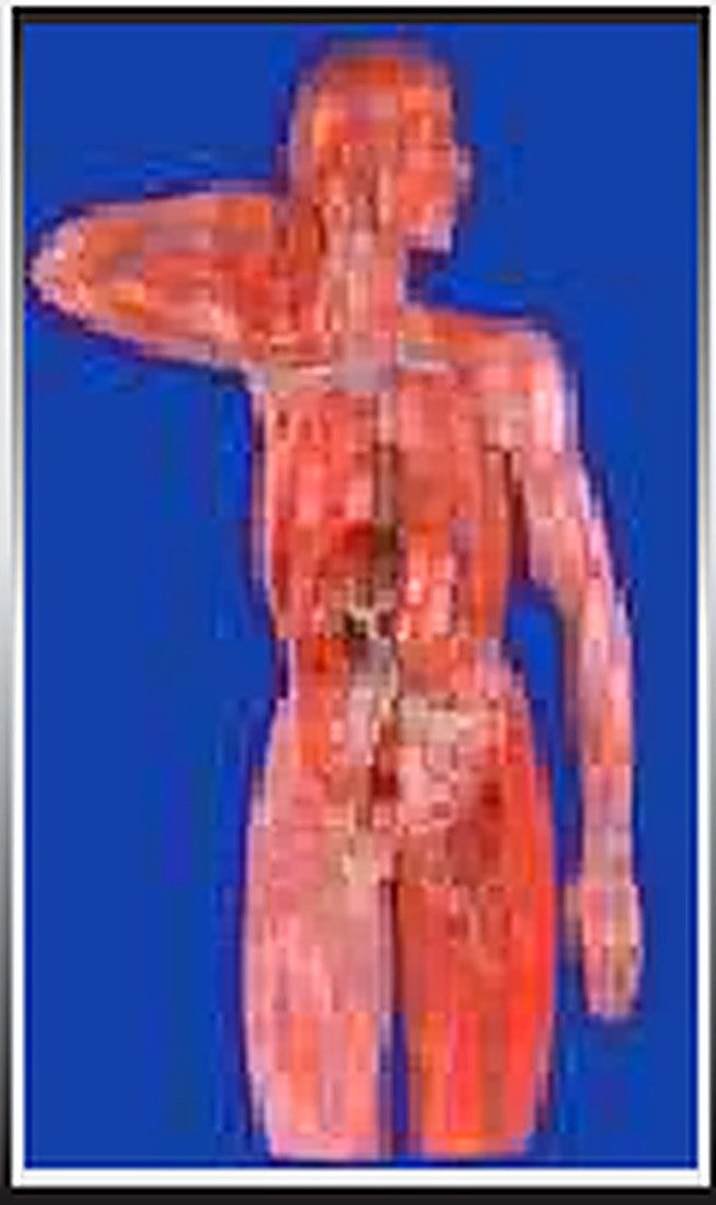 LYMPHETIC SYSTEM MODEL (IMPORTED) –