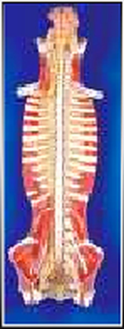 SPINAL CORD IN SPINAL CANAL(IMPORTED) -