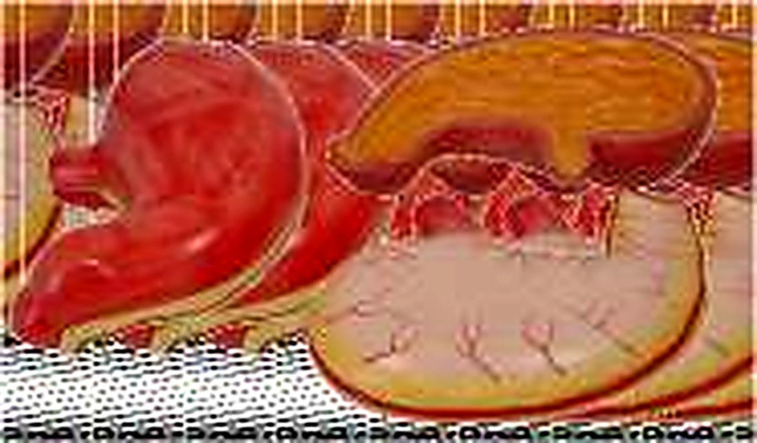 STOMACH MODEL (IMPORTED) - the model shows the structures of the gastric folds, pyloric valve, pyloric sphincter muscles, gastric mucosa and the transitional mucosa of the gastric-esophagus. Made of hard plastic and magnified 2 times of the natural size.
